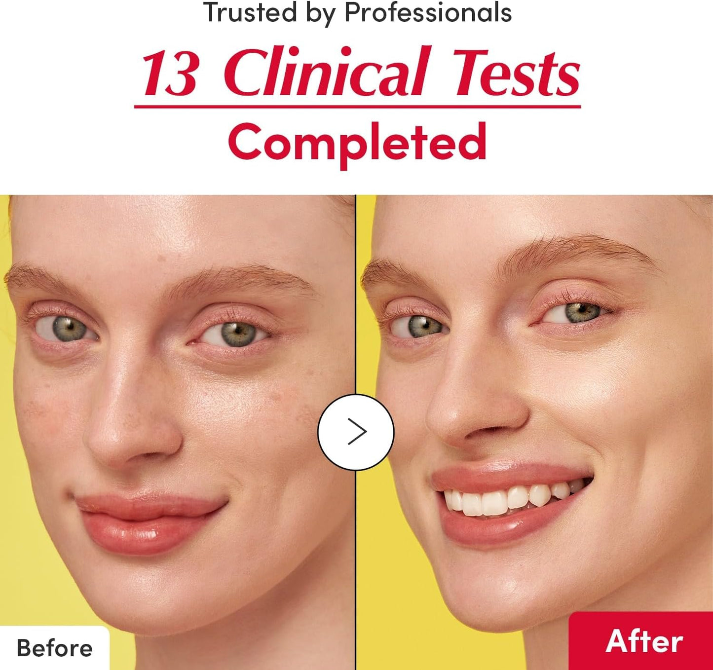 سيروم تفتيح فيتامين سي 30 مل